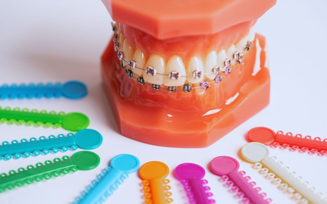 Protegido: ¿Cuándo es el mejor momento para empezar un tratamiento de ortodoncia?